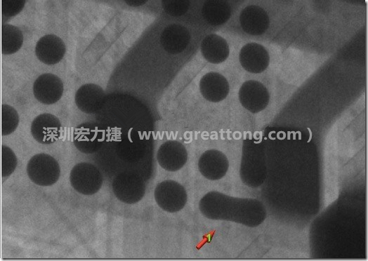 BGA因為焊墊變小，造成錫膏過多而最終形成焊接短路的結果。